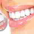 ranking środków wybielających zęby