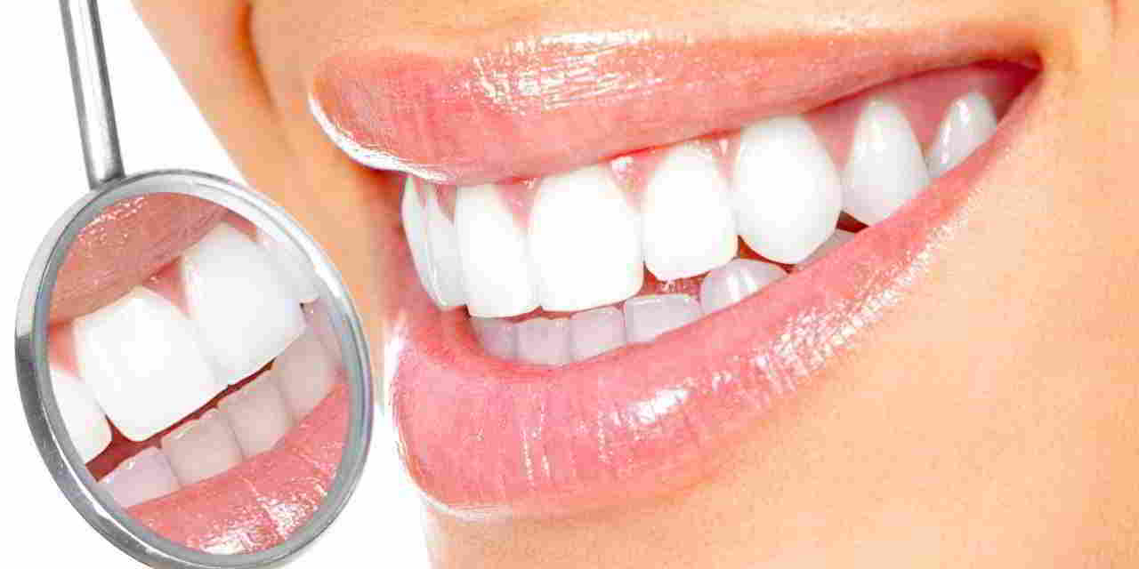 Ranking środków wybielających zęby ✅